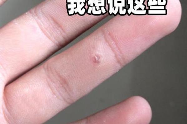 头上长瘊子好不好算命