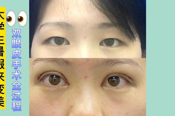 倒八字眼睛 倒八字眼睛