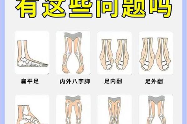 婴儿八字腿 婴儿八字腿